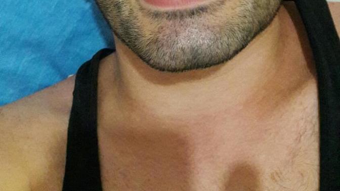 Dişimin ucunu kırdım düzeltilebilir mi😓?