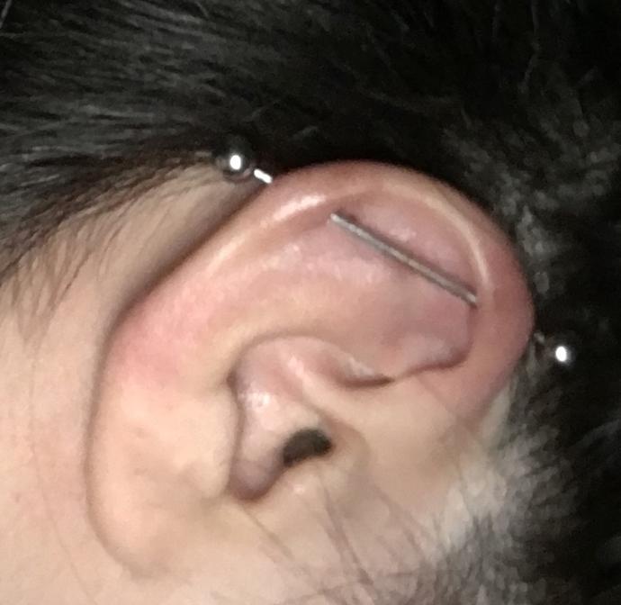 Piercing yaptirdim cok aciyor bir bakar misiniz?