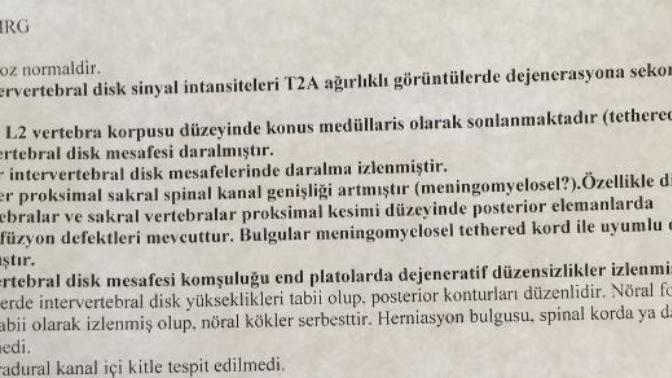 MR sonuç raporu gerçekten okuyabilen varsa yardımcı olabilir mi?