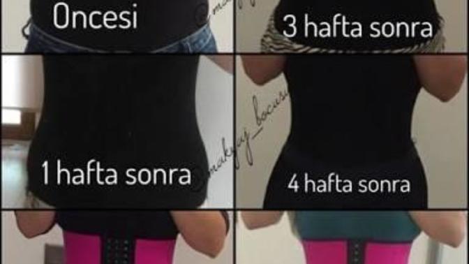 Yamune korse işe yarıyor mu?