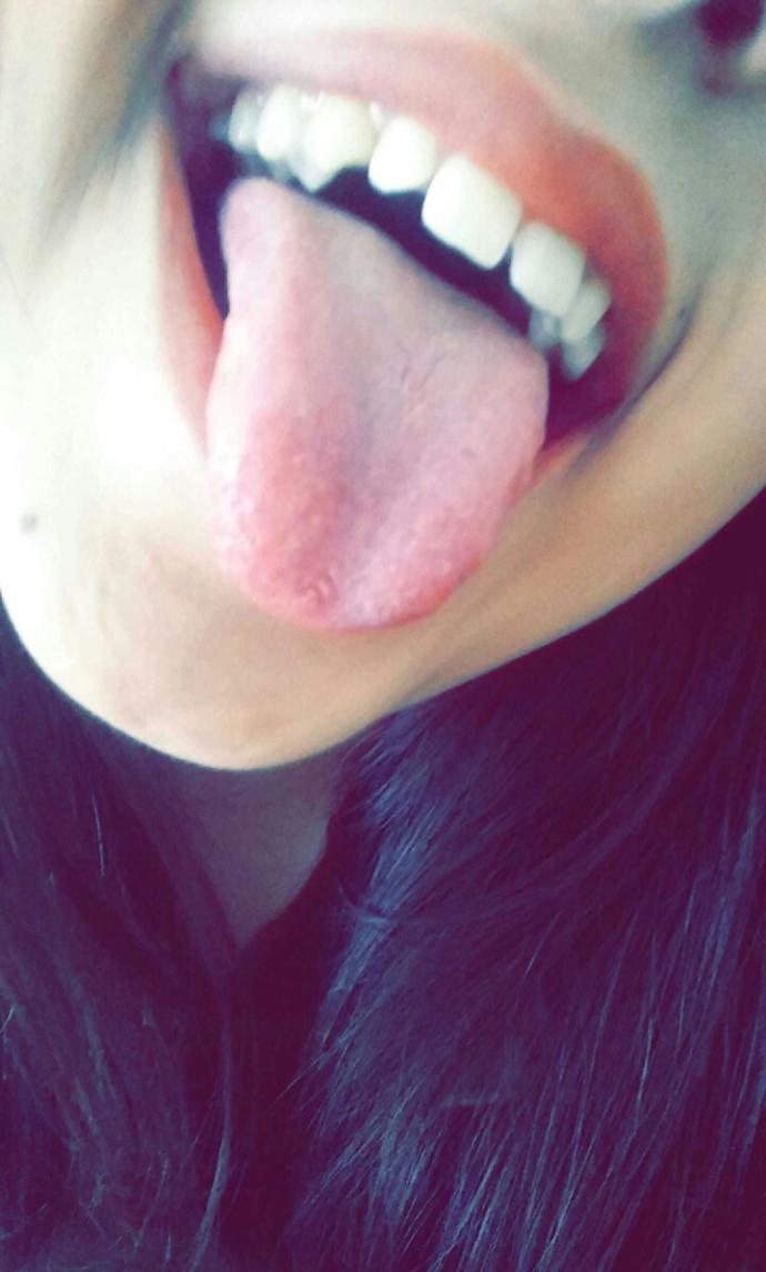 smiley piercing yaptirmak istiyorum dişlerim ayrik kötü dururmu??