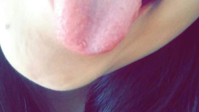 Smiley piercing yaptirmak istiyorum dişlerim ayrik kötü dururmu?