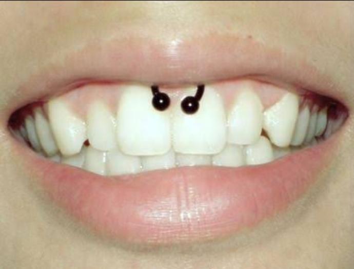 Sizce smiley piercing bana yakışır mı?
