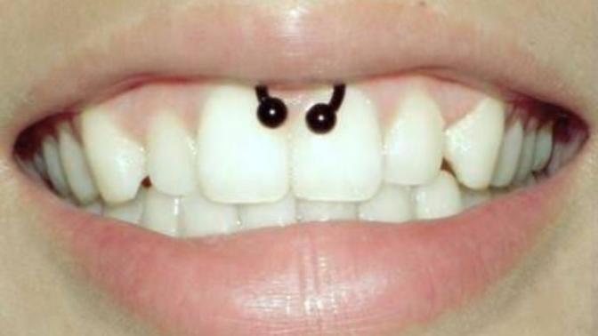 Sizce smiley piercing bana yakışır mı?