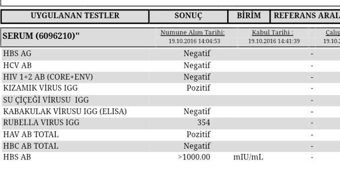 Arkadaslar bu tahlil sonucunda kabakulak ve kızamık icin yorum yaparmsnz biliyorsaniz aşı olmam gereklimi. stajlar icin?