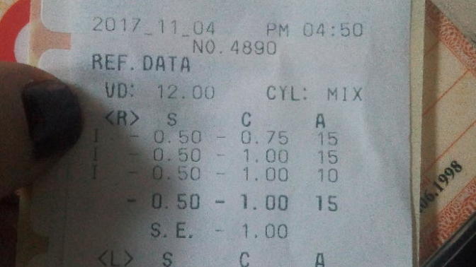 MİYOP ASTİGMAT İYİLESİR Mİ?