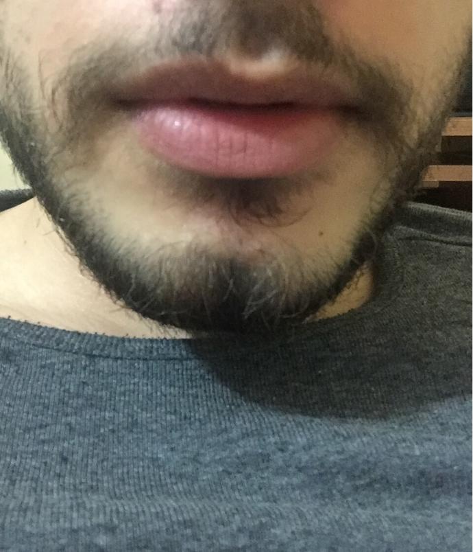 Arkadaşlar bıyıklarımı nasıl daha gür yapıpve çoğaltabilirim bıyıklarım var ama daha kalın ve çok çıkmasını istiyorum?