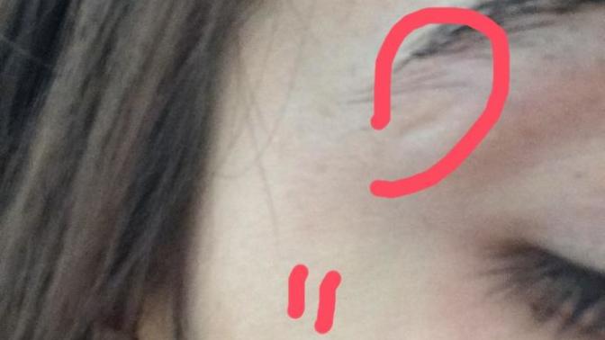 Yüzümdeki yara izine bir bakar mısınız, geçer mi sizce?