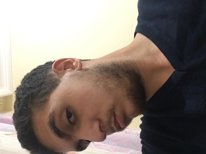 Sakalım nasıl gürleşir?