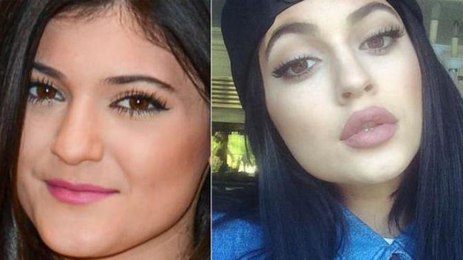 Dudağı estetik olupta güzel duranı gördünüz mü?