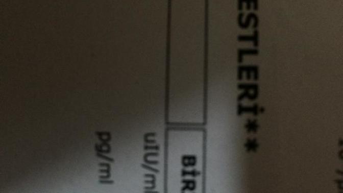 Arkadaşlar bu ne?