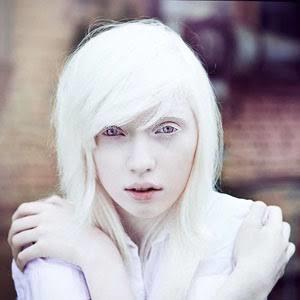 Albino güzelliği ?