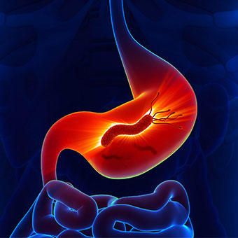 Güçlü , Dayanıklı , Sinsi ... O HELİCOBACTER PYLORİ ?