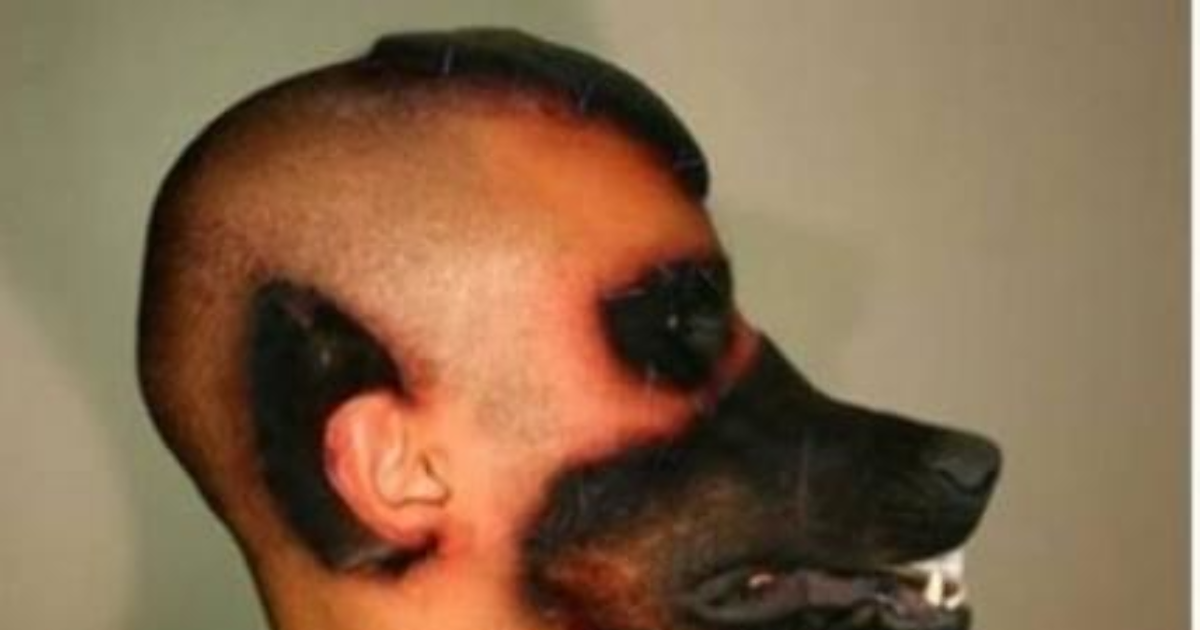 Estetik ameliyatla köpeğin yüzünü kendine diktirtip köpeğe benzeyen