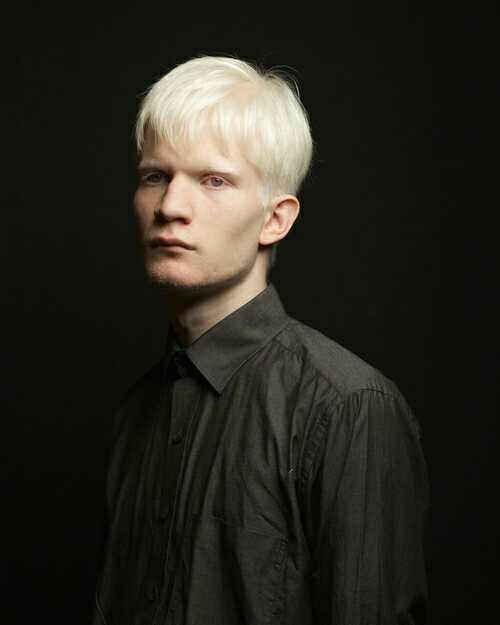 Albino erkekler hakkında ne düşünüyorsunuz??