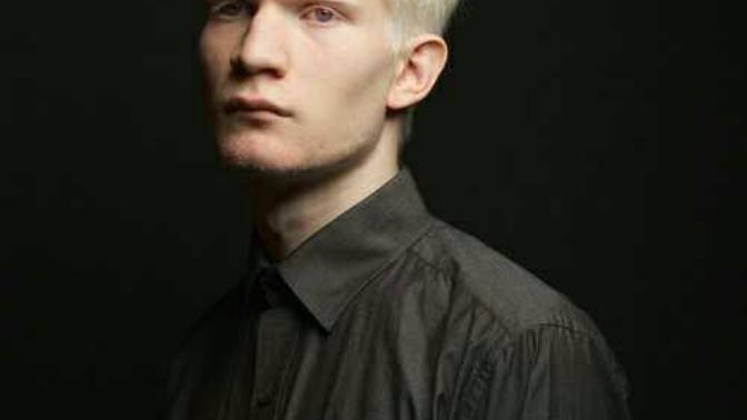 Albino erkekler hakkında ne düşünüyorsunuz?