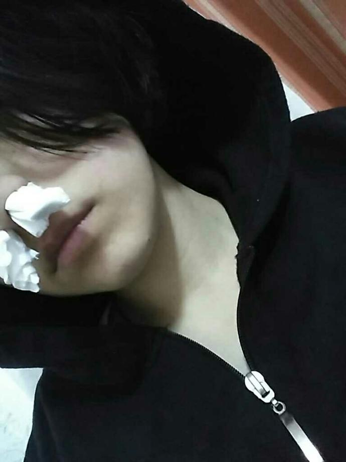 burnum akıyor yardım :(?