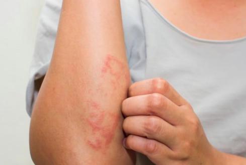 derma nedir