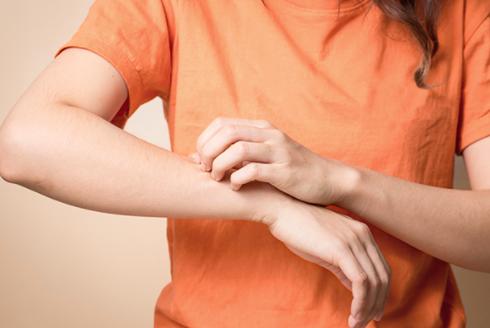 derma nasıl geçer
