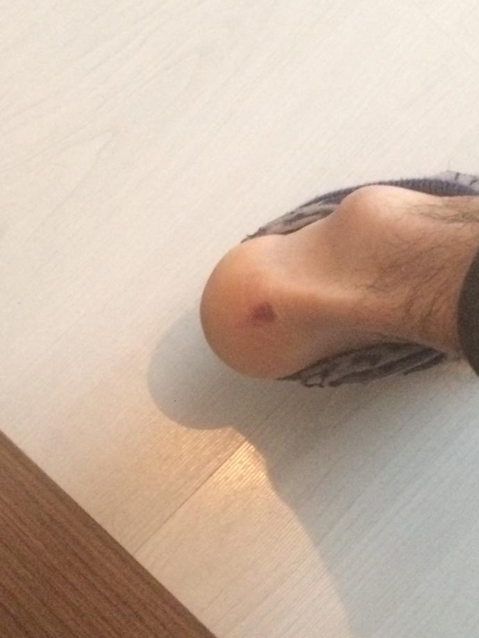 (Resimli) Boyum 1,83 yorum yapmadan geçmeyin daha uzun gözükmek için ve daha uzun olmak için ne yapmam gerek?