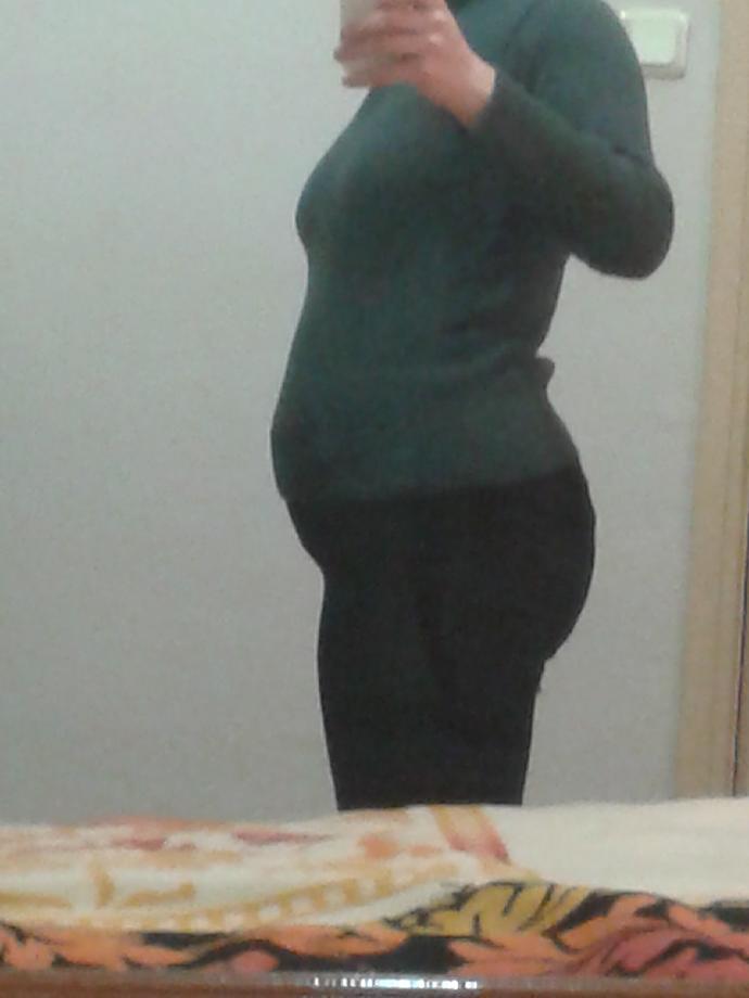 164 boyum 64 kiloyum sizce obez miyim (fotoğrafli)?