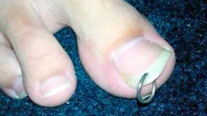 Tırnağa piercing takılır mı :o?