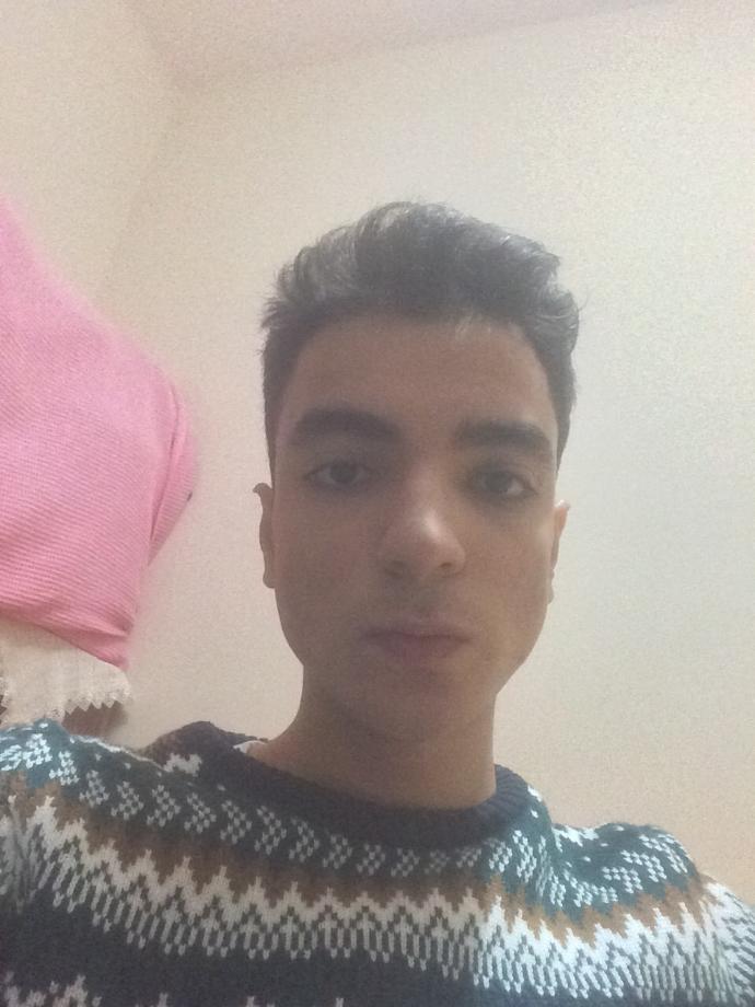<br />Arkadaşlar okulda 5kişiyle kavga ettim (dayak yedim) burnum yamuldu<br />(Resimli) ameliyat olsam düzelirmi ?