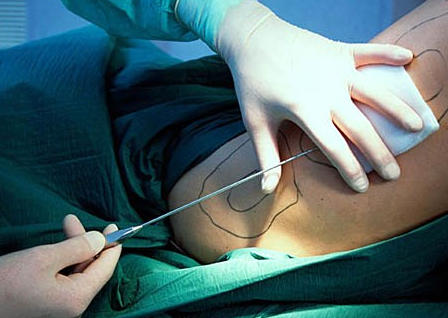 Estetiksellikten ziyade sağlık açısından da kadında en ideal vücut tipinin ''kum saati'' olduğunu biliyor muydunuz?