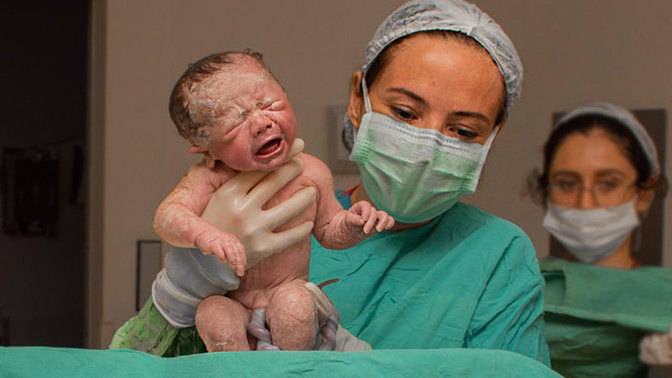 Epidural doğum yapanlar var mı aranızda, öneriyor musunuz?