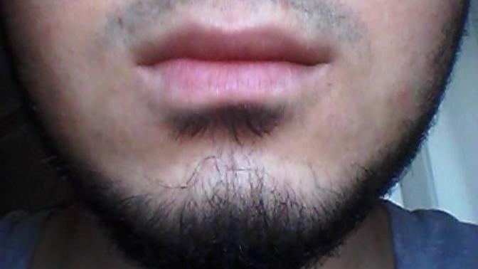 Yüzüm cok kirli gözüküyor ne yapmam lazım? Resmim var?