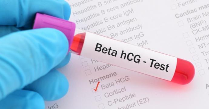 Beta HCG 