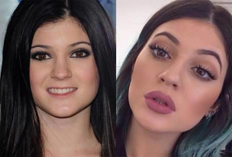 Dolgun dudaklara sahip olmanın avantajları ve dezavantajları sizce nelerdir?