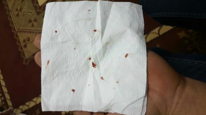 Bu peçetedeki kan nasıl oldu sizce?