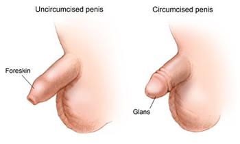 Aramızda kaç Türk kadın veya erkek sünnetsiz penis gördü? Hangisini tercih edersiniz?