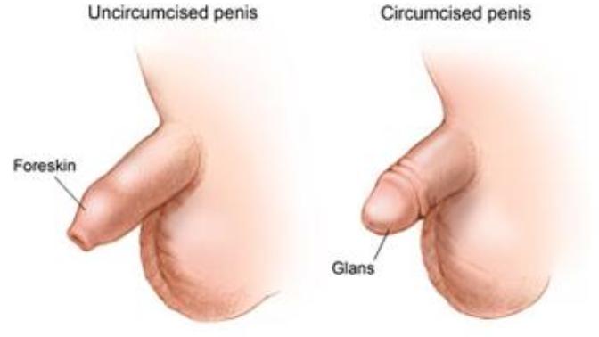 Aramızda kaç Türk kadın veya erkek sünnetsiz penis gördü? Hangisini tercih edersiniz?