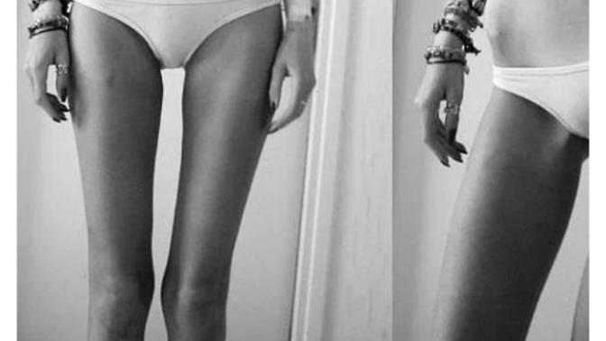 Thigh Gap i çekici buluyor musunuz?