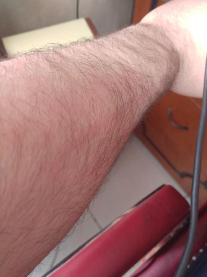 KOL KILLARI ÇOK MU FAZLA ARKADAŞLAR LÜTFEN BAKAR MISINIZ NE YAPMAYALIYIM ?