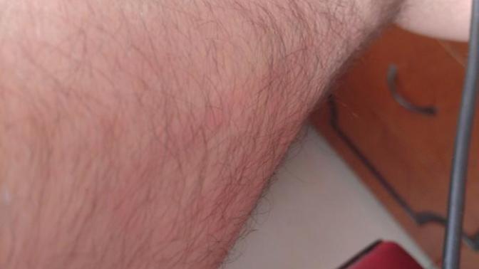 KOL KILLARI ÇOK MU FAZLA ARKADAŞLAR LÜTFEN BAKAR MISINIZ NE YAPMAYALIYIM?