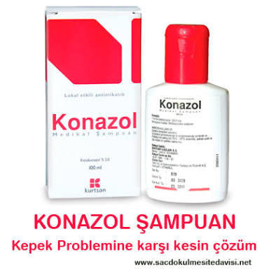 Konazol şampuan kullanan var mı kepeği geçiriyormu acaba ?