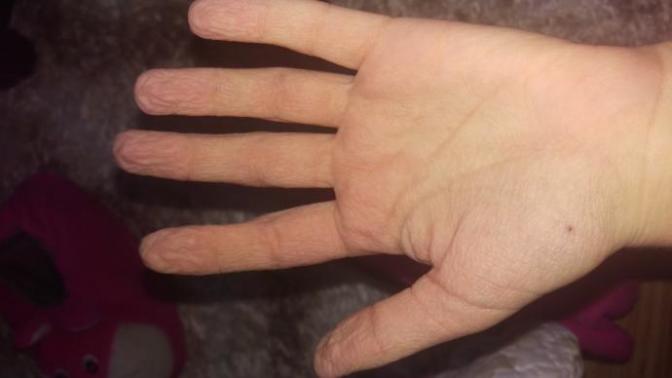 20 dakikalık banyodan sonra bu kadar burusmak normal mi?