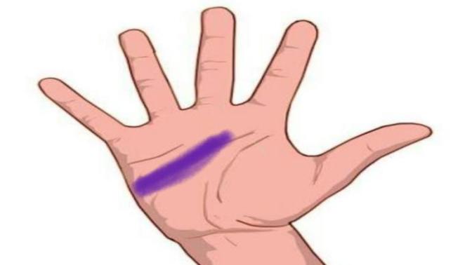 Lütfen yardım edin konu sağlık, Elime 14 tane dikiş atıldı (resimli) ?