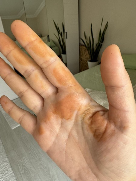 Cin musallatı yaşayıp kurtulan var mı?