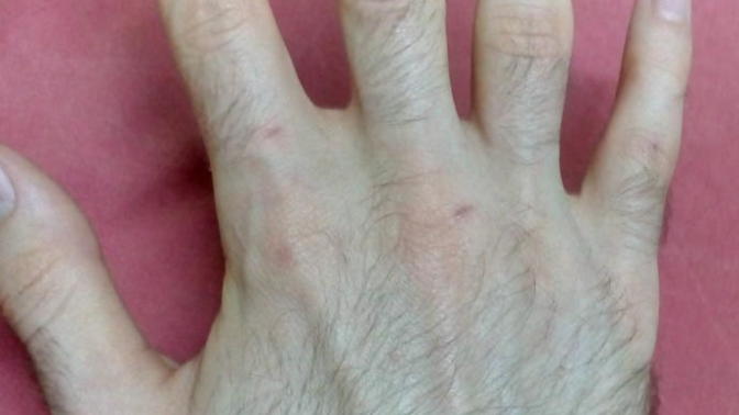 Elleri kıllı erkekmi kılsız erkek mi?