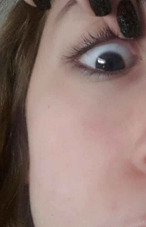 Bu ittirse mi sivilce mi?