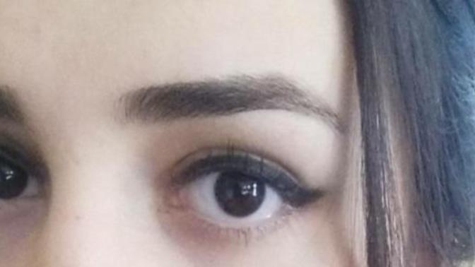 Pörtlek göz böyle birşey mi?