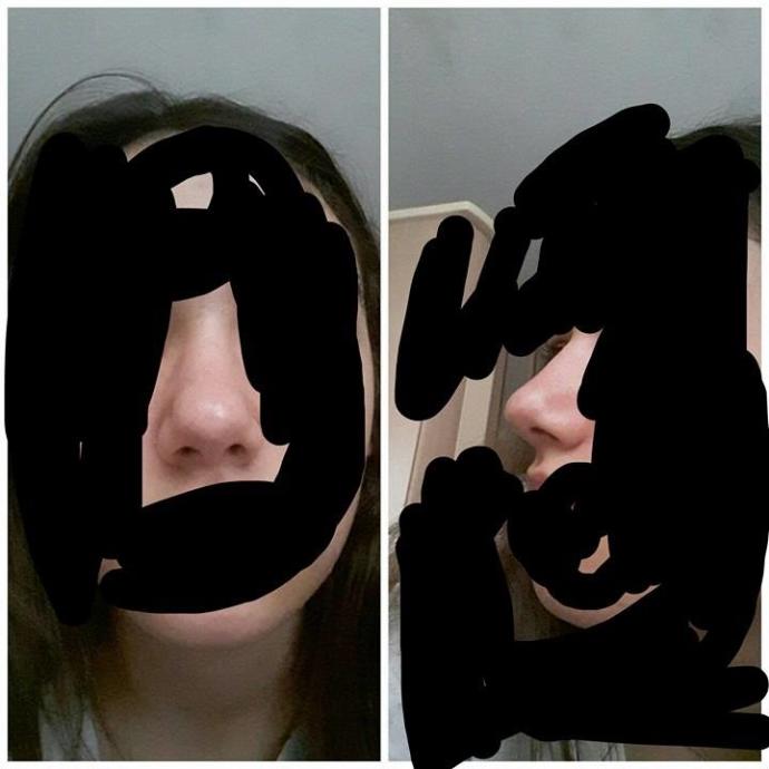Sizce burnum nasıl arkadaşlar?