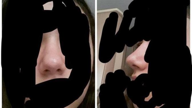 Sizce burnum nasıl arkadaşlar?
