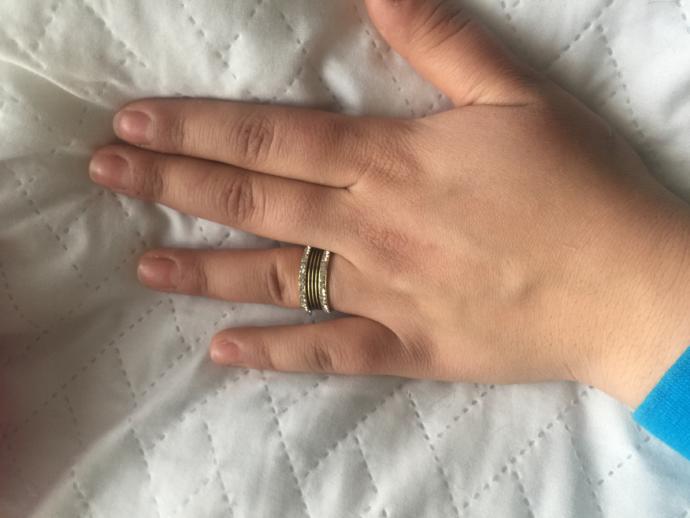 Ellerim çok kötü etli nisanım olacak sizce de çok mu kötü ?