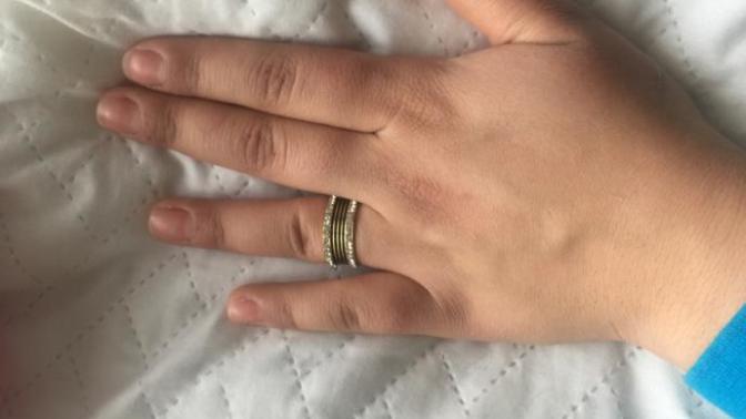 Ellerim çok kötü etli nisanım olacak sizce de çok mu kötü?