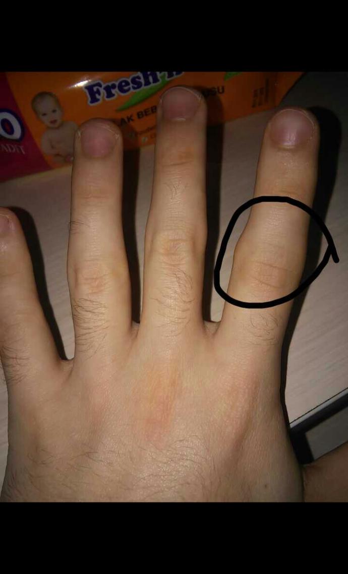 arkadaşlar sizce bu çıkık mı?